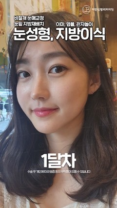 韩国鼻综合，韩国抗衰整形，韩国鼻修复_韩国耳畔URBAN