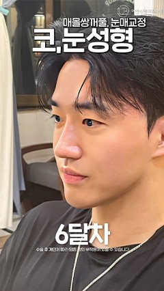 韩国鼻综合，韩国抗衰整形，韩国鼻修复_韩国耳畔URBAN