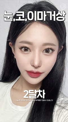 韩国鼻综合，韩国抗衰整形，韩国鼻修复_韩国耳畔URBAN