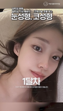 韩国鼻综合，韩国抗衰整形，韩国鼻修复_韩国耳畔URBAN