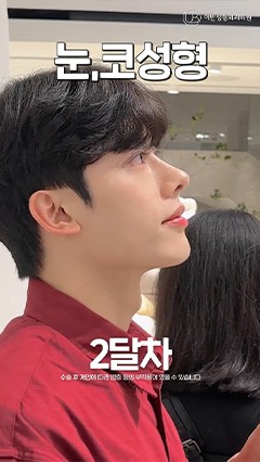 韩国鼻综合，韩国抗衰整形，韩国鼻修复_韩国耳畔URBAN