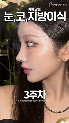 韩国鼻综合，韩国抗衰整形，韩国鼻修复_韩国耳畔URBAN