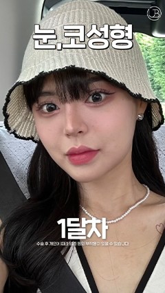 韩国鼻综合，韩国抗衰整形，韩国鼻修复_韩国耳畔URBAN
