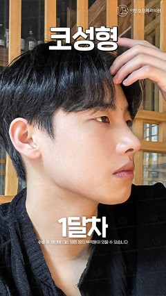 韩国鼻综合，韩国抗衰整形，韩国鼻修复_韩国耳畔URBAN